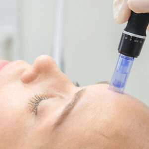 Purlés Derma Solution Online Course (Microneedling)