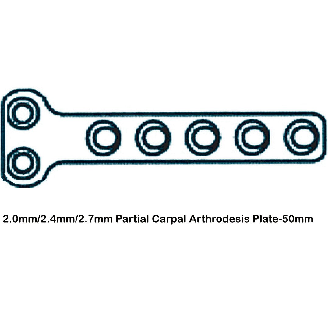 Partial Carpal Arthrodesis Plate - Image 3