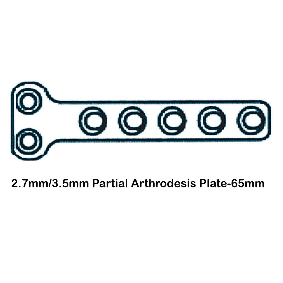 Partial Carpal Arthrodesis Plate - Image 4